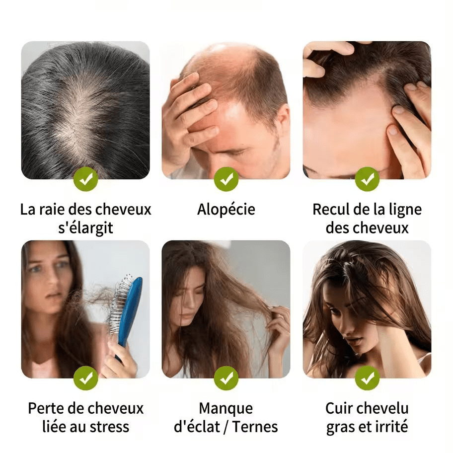 Elixir: Pousse Accélérée - Welii