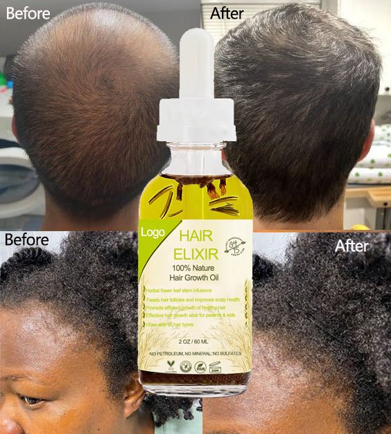 Elixir: Pousse Accélérée - Welii
