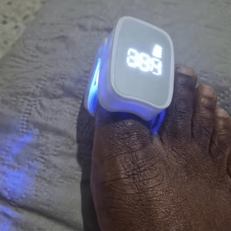Laser UVC anti - champignons: mains et pieds - Welii