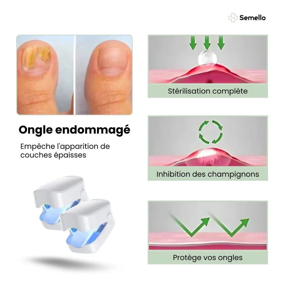 Laser UVC anti - champignons: mains et pieds - Welii