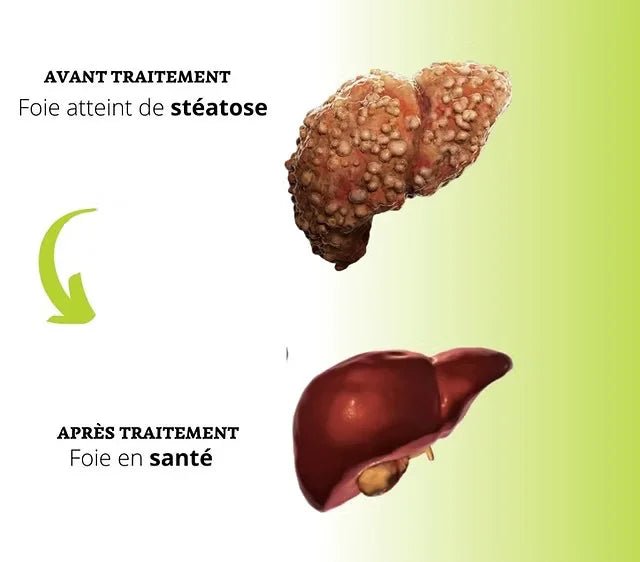 Milk Thistle - Détoxifiant pour Foie - Welii