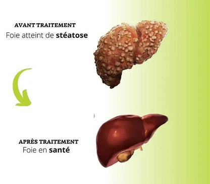 Milk Thistle - Détoxifiant pour Foie - Welii