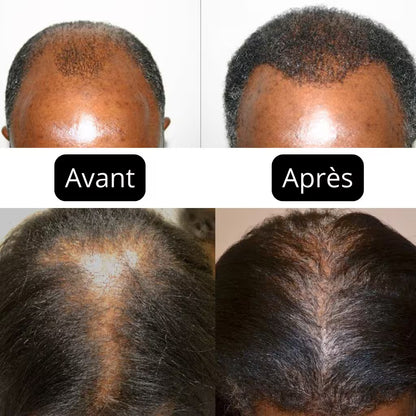 Elixir: Pousse Accélérée